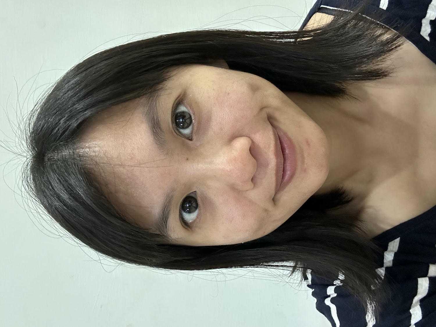 台中佳思優醫美診所。第一次的皮秒雷射經驗分享。恢復期保養需要注意的地方。 - 第22張圖