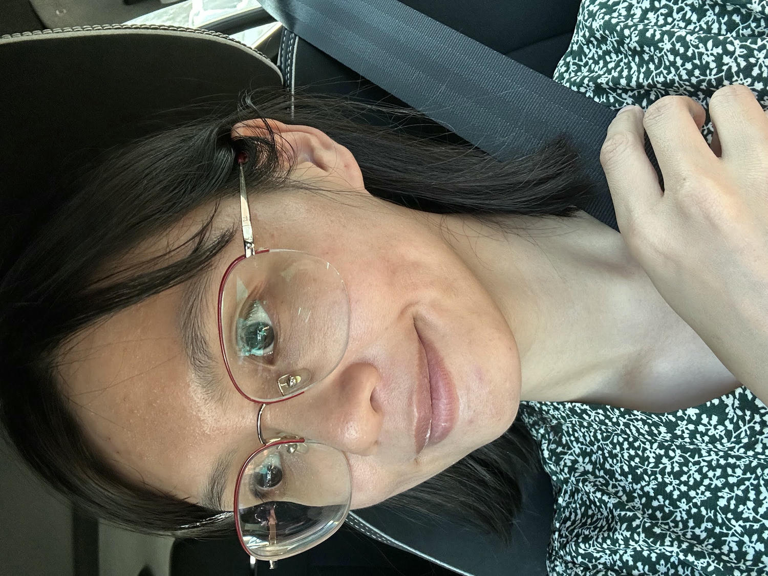 台中佳思優醫美診所。第一次的皮秒雷射經驗分享。恢復期保養需要注意的地方。 - 第21張圖