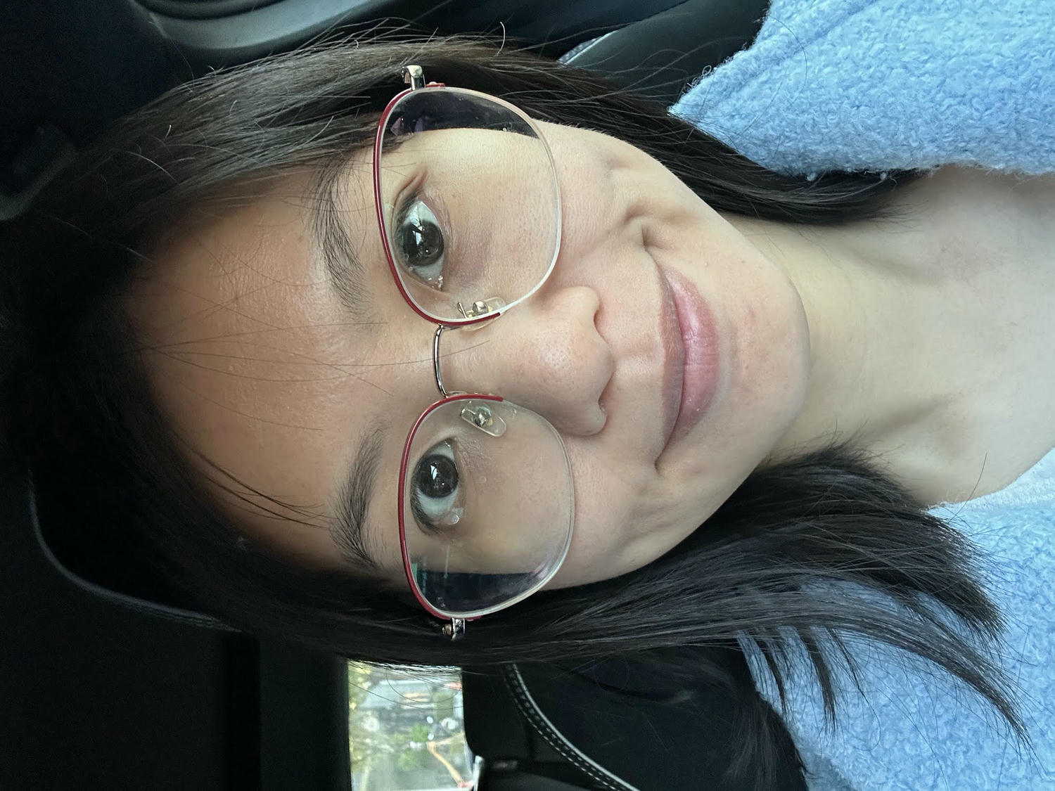 台中佳思優醫美診所。第一次的皮秒雷射經驗分享。恢復期保養需要注意的地方。 - 第23張圖